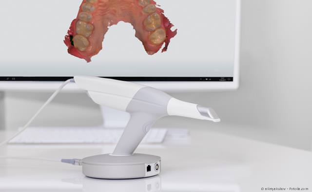 Digitale Abformung mit 3D-Scanner