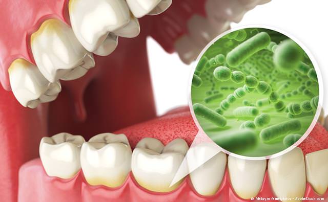 Hochwertiger Zahnersatz: Zahnkronen, Zahnbrücken und Zahnprothesen