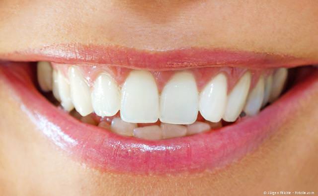 Schöne Zähne mit Bleaching (Zahnaufhellung), Schönheitskorrekturen und mehr